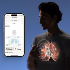 Withings BeamO 4-in-1 Health MultiScan